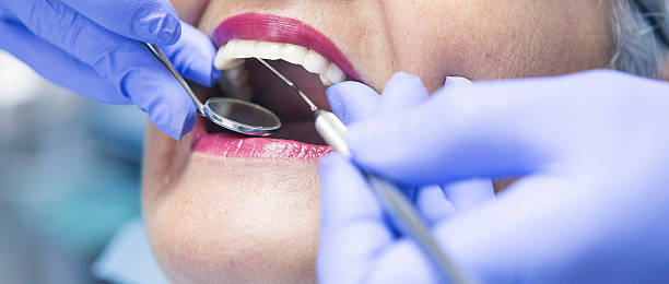 Best Emergency Root Canal Treatment in Waterloo, IL